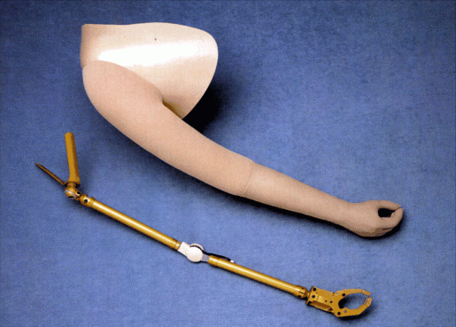 Versorgung bei Schulteramputation