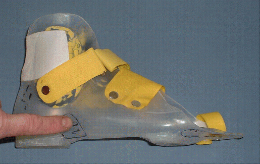 Nancy Hilton Orthese