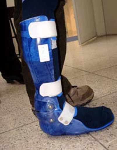 Unterschenkel Gehorthese mit Gelenk