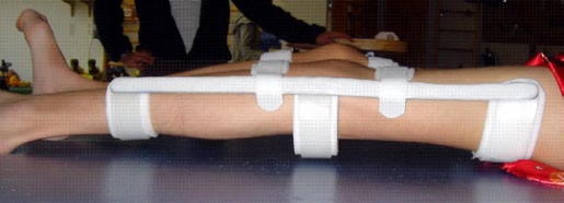 Knieschienestreckschiene Biedermannschiene