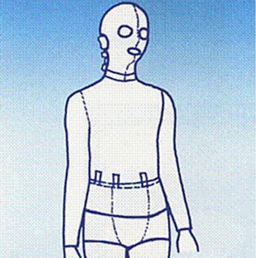 Kompressionsbandagen nach Verbrennungen