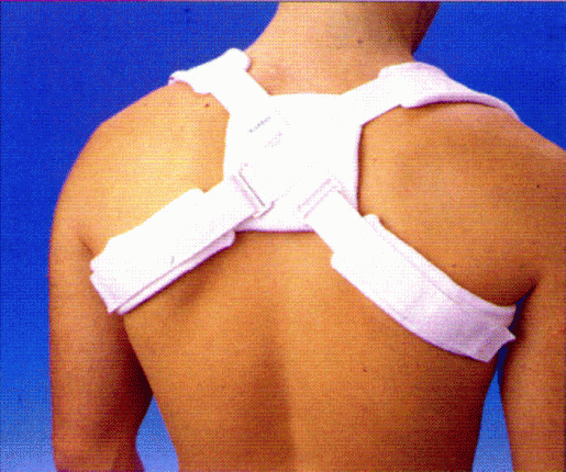 Clavicula-Frakturbandage