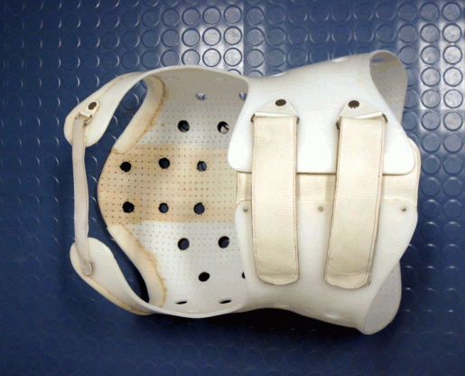 Fixationskorsett Kunststoff